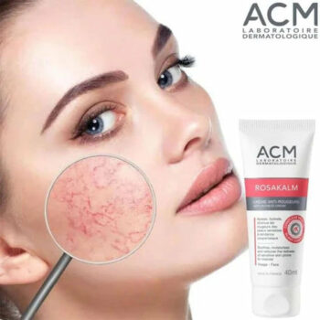 ACM rosakalm